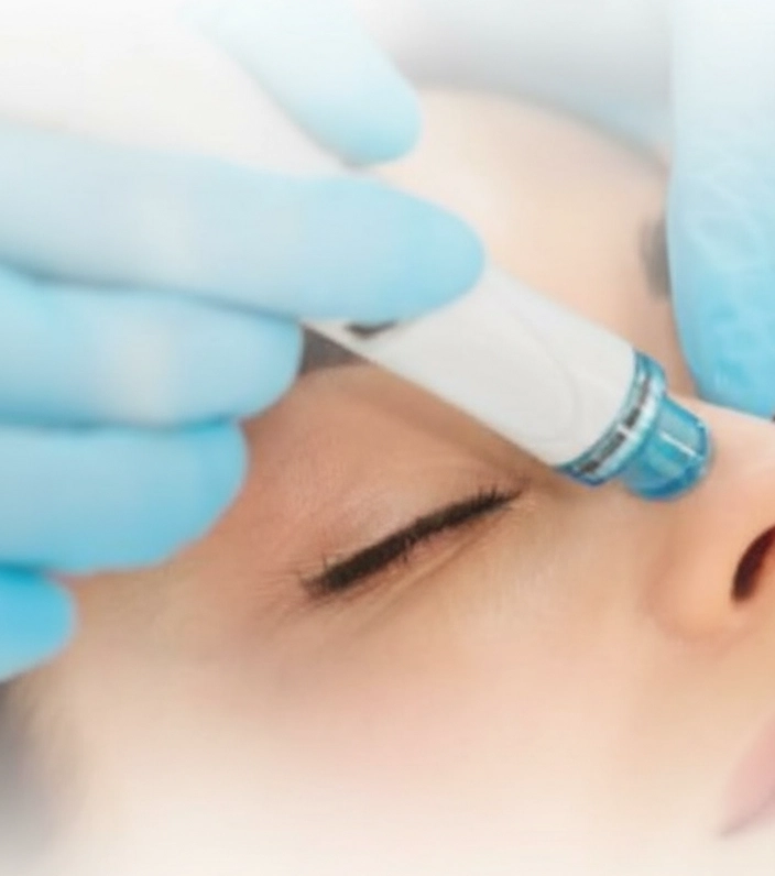 Higiene Facial con Hidrodermoabrasión